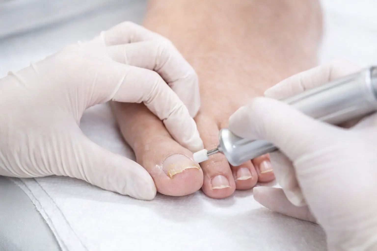 Comp. Nutra_FUNGUS TREATMENT