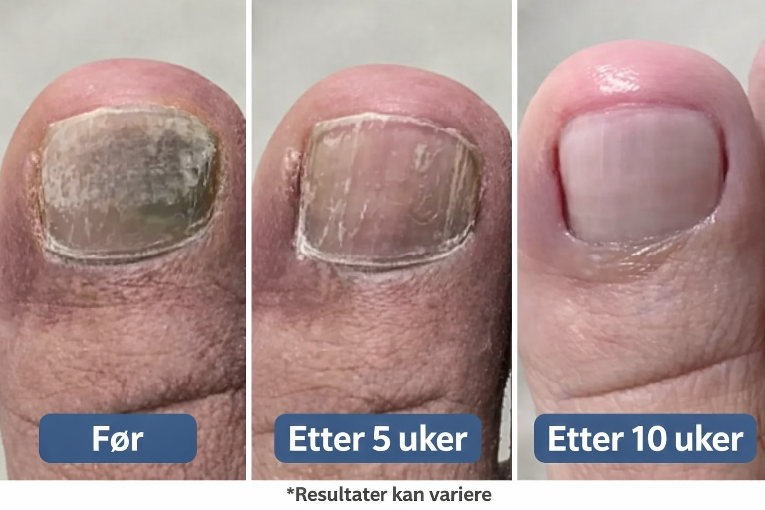 Resultatet? En smartere og mer skånsom tilnærming som går rett til kjernen av problemet