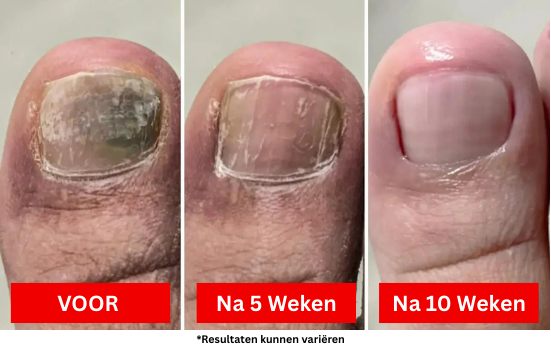 Het resultaat? Een slimmere, zachtere aanpak die de bron van het probleem aanpakt