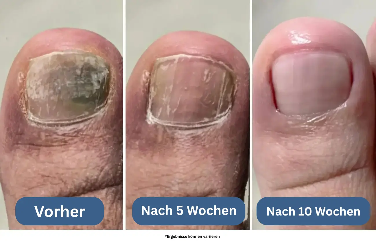 Das Ergebnis? Ein smarterer, sanfterer Ansatz, der die Ursache angeht