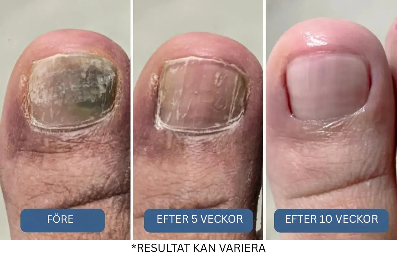 Resultatet? En smartare, skonsammare metod som går på själva roten av problemet