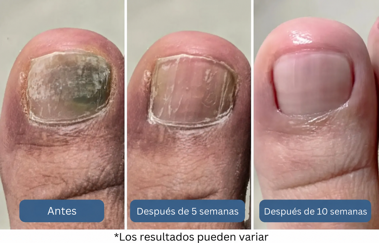¿El resultado? Un enfoque más inteligente y suave que actúa directamente sobre el origen del problema.