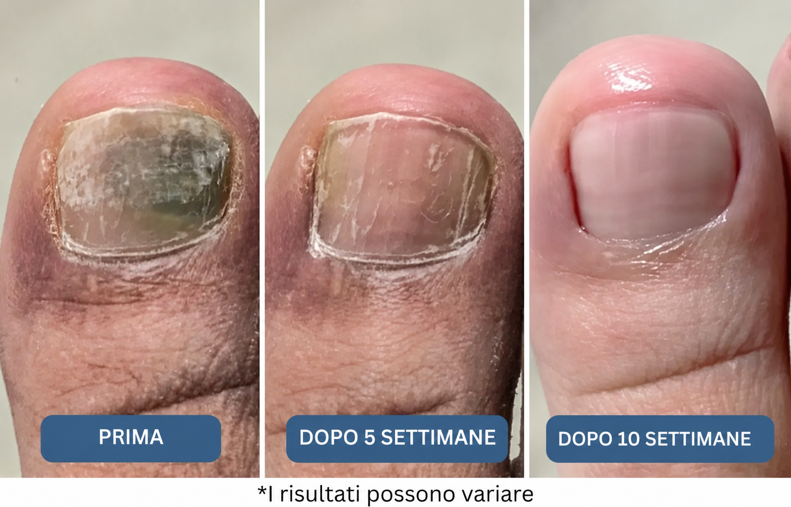 Il risultato? Un approccio più intelligente e delicato che agisce direttamente alla radice del problema
