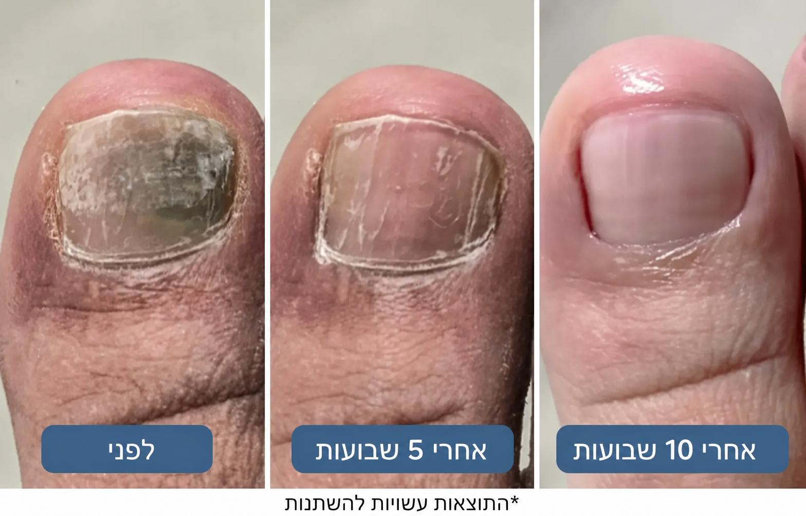 התוצאה? גישה חכמה ועדינה יותר שפועלת ישירות בשורש הבעיה