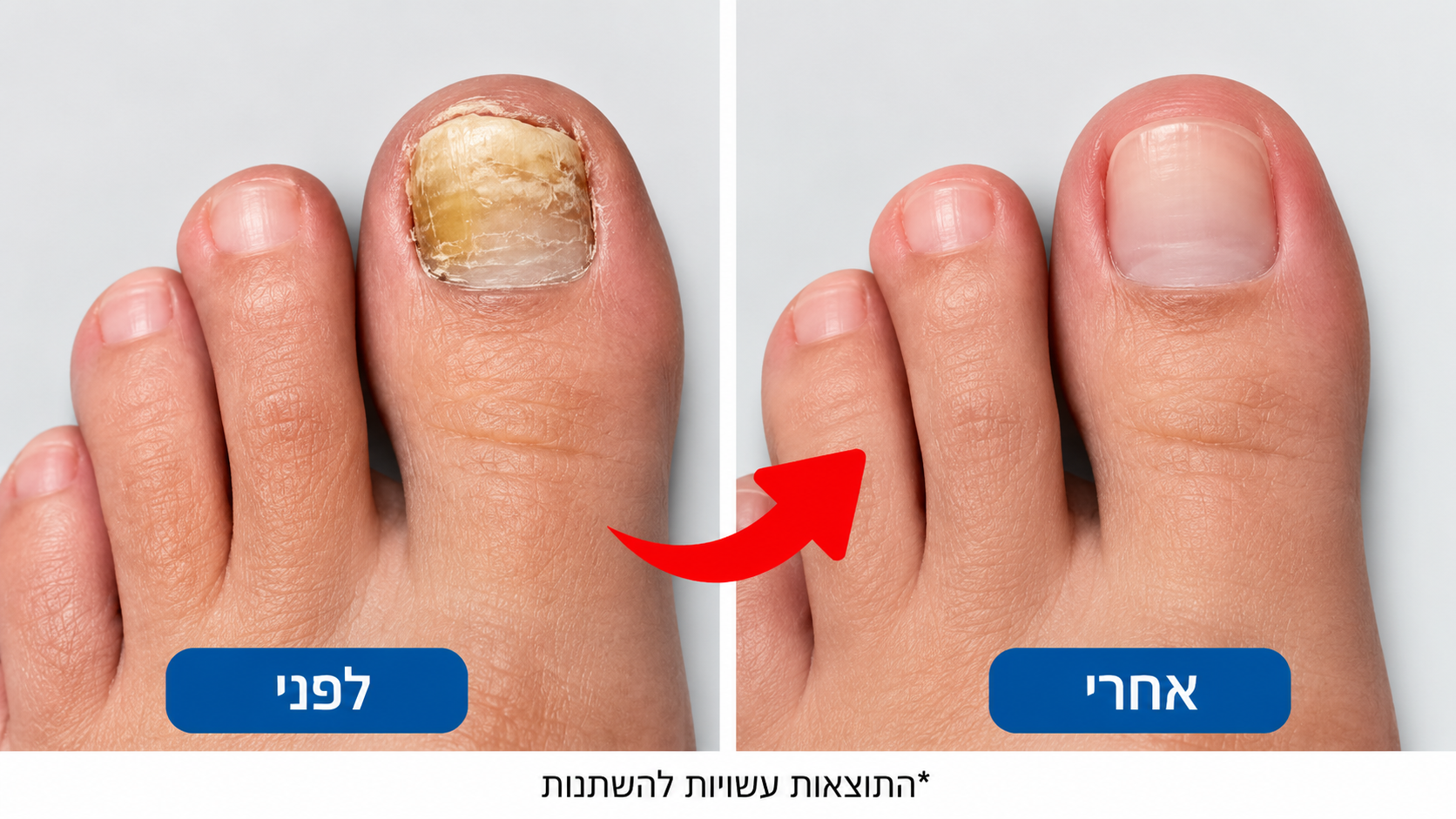 הייתי ספקנית, אבל אי אפשר להתווכח עם התוצאות