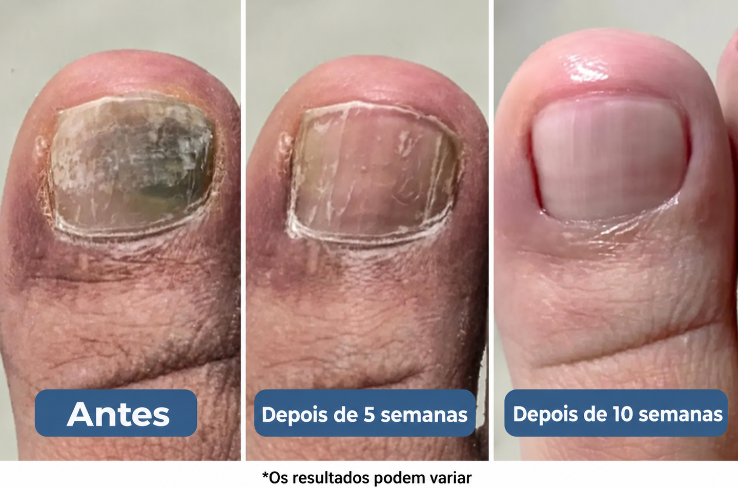 O Resultado? Uma Abordagem Mais Inteligente e Suave Que Vai à Origem do Problema